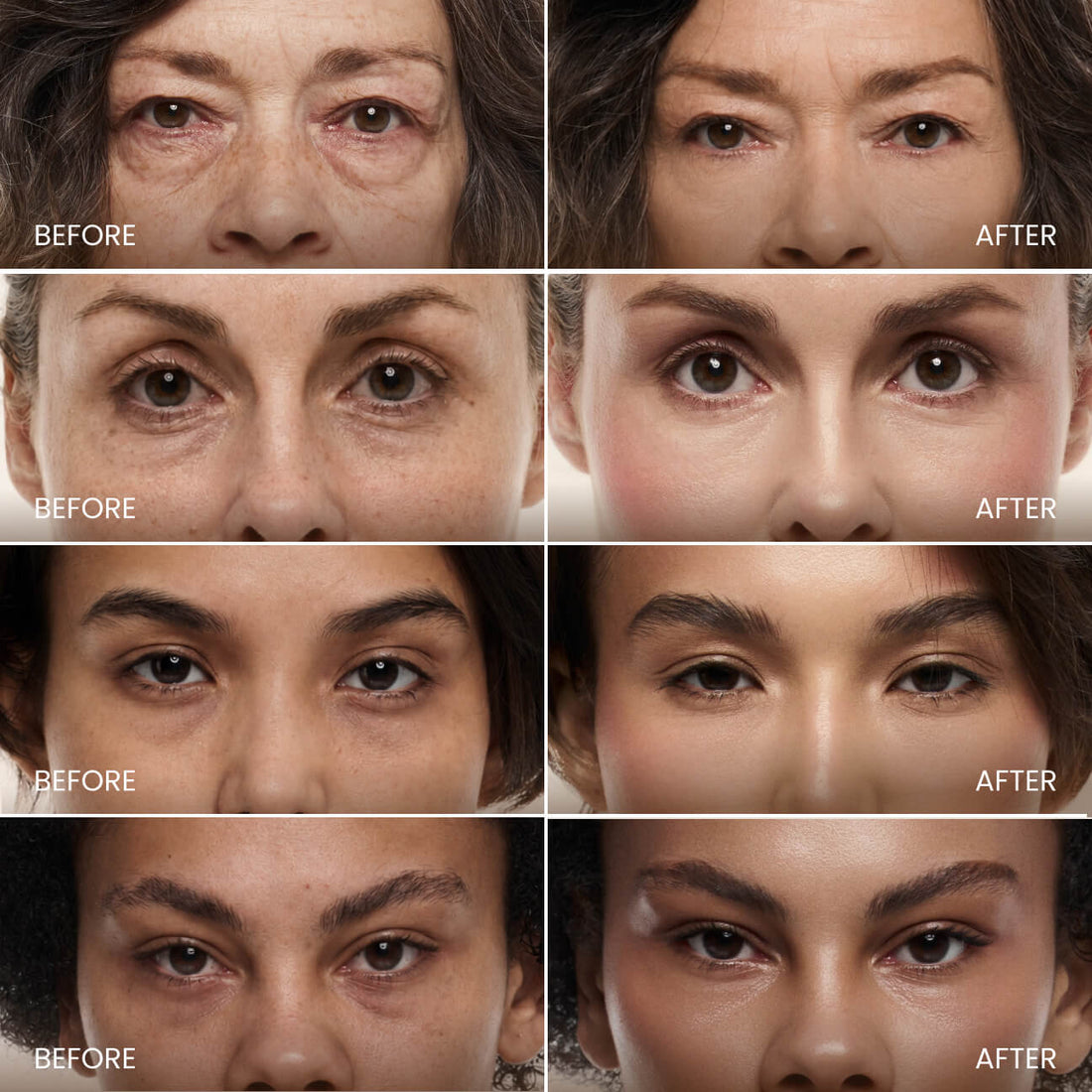 2. Discover the "Espresso for Your Under-Eyes" Effect Women 55+ Can't Stop Talking About